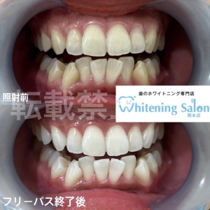 【何回噛んでいますか？】