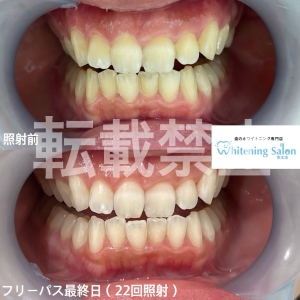【よく噛むことのメリット】