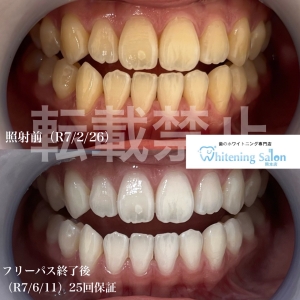 【メンテナンス】