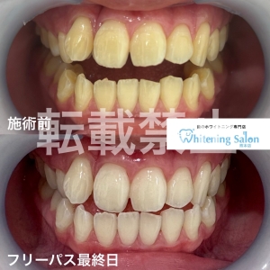 【歯ブラシを交換する理由 】