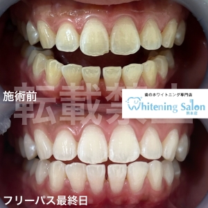【ワンタフトブラシとは】