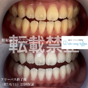 【健康は歯の状態とは？】