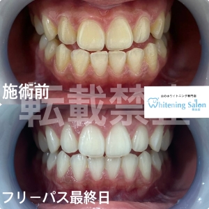【口臭の原因とは？】