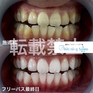 【お忙しい方、イベントを控えている方必見！】