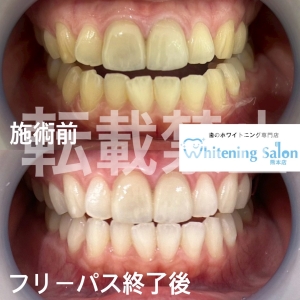 【だらだら食べは危険？】