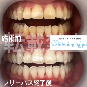 【健口寿命とは？】