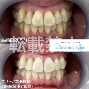 【セルフって難しくないの？】