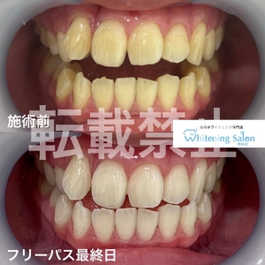 【ご紹介特典あります☆】