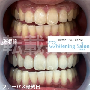 【着色がつきやすい食品】