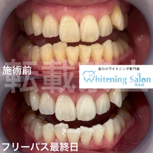 【メンテナンスで白さ長持ち！】