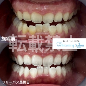 【メンテナンス】
