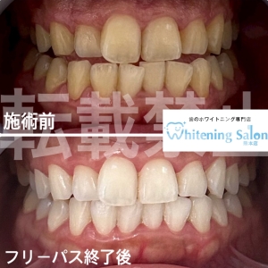 【当店の営業時間は？】熊本/ホワイトニング